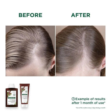 Klorane anti-hårtab shampoo + balsam Klorane anti-hair loss shampoo + conditioner - Hairgivers