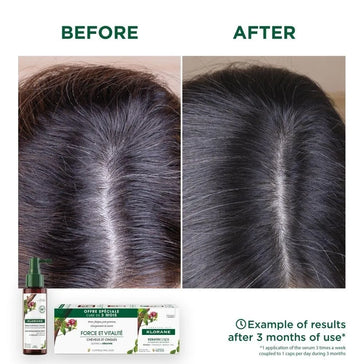 Klorane anti-hair loss treatment Klorane anti-hair loss treatment - Hair Growth Specialist