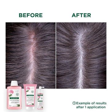 Klorane treatment for sensitive scalp Klorane treatment for sensitive scalp - Hair Growth Specialist