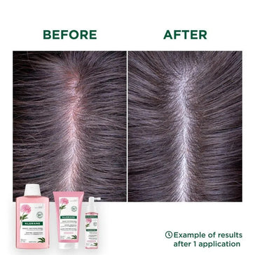 Klorane-behandling til følsom hovedbund Klorane treatment for sensitive scalp - Hairgivers