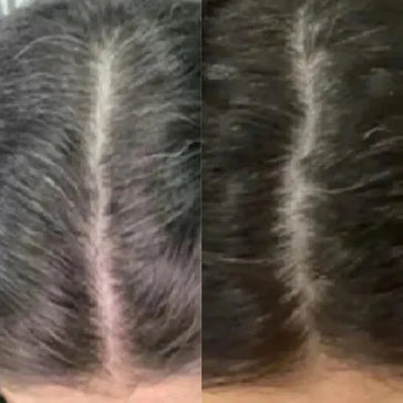 Neofollics tabletter mot grått hår Neofollics anti-grey hair tablets - Hair Growth Specialist