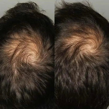 Viviscal hårväxttabletter för män (3 månader) Viviscal hair growth tablets for men (3 months) - Hair Growth Specialist