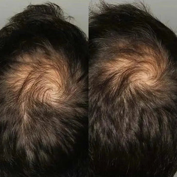 Viviscal hårvæksttabletter til mænd (3 måneder) Viviscal hair growth tablets for men (3 months) - Hairgivers