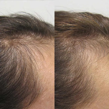 Viviscal hårväxttabletter för kvinnor (3 månader) Viviscal hair growth tablets for women (3 months) - Hair Growth Specialist