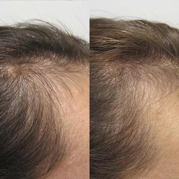 Viviscal hårvæksttabletter til kvinder (3 måneder) Viviscal hair growth tablets for women (3 months) - Hairgivers