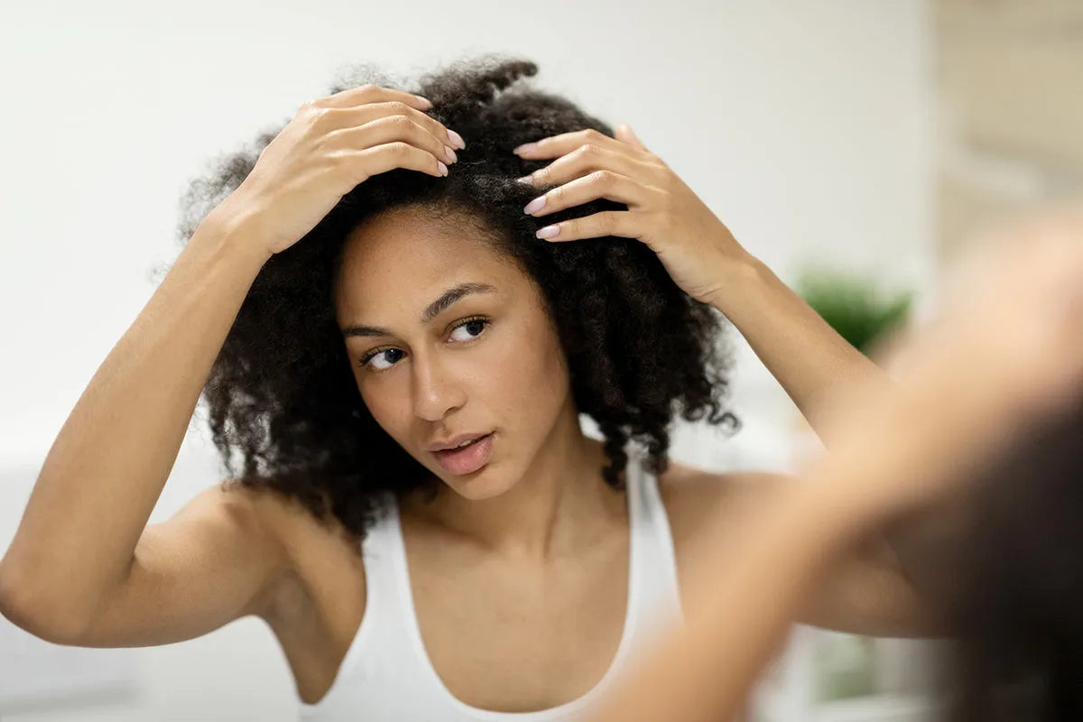Alopeci prematura