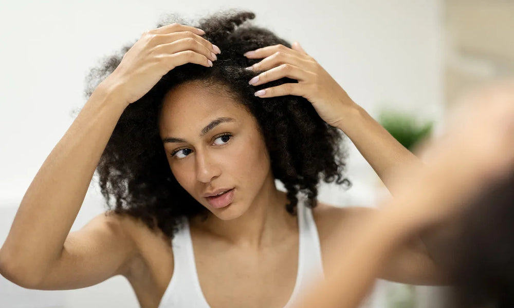 Alopeci prematura