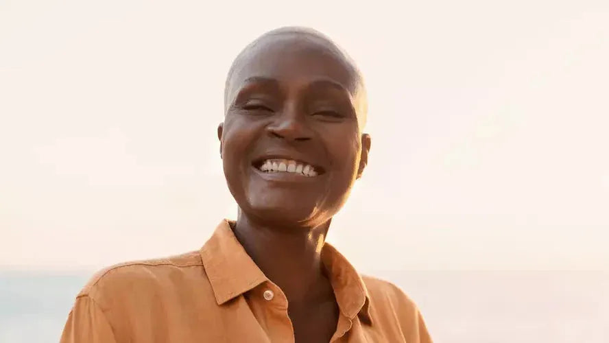 Alopecia totalis: fullständigt håravfall