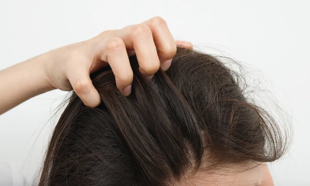 Suffering from psoriasis on your scalp? Discover the causes and solutions