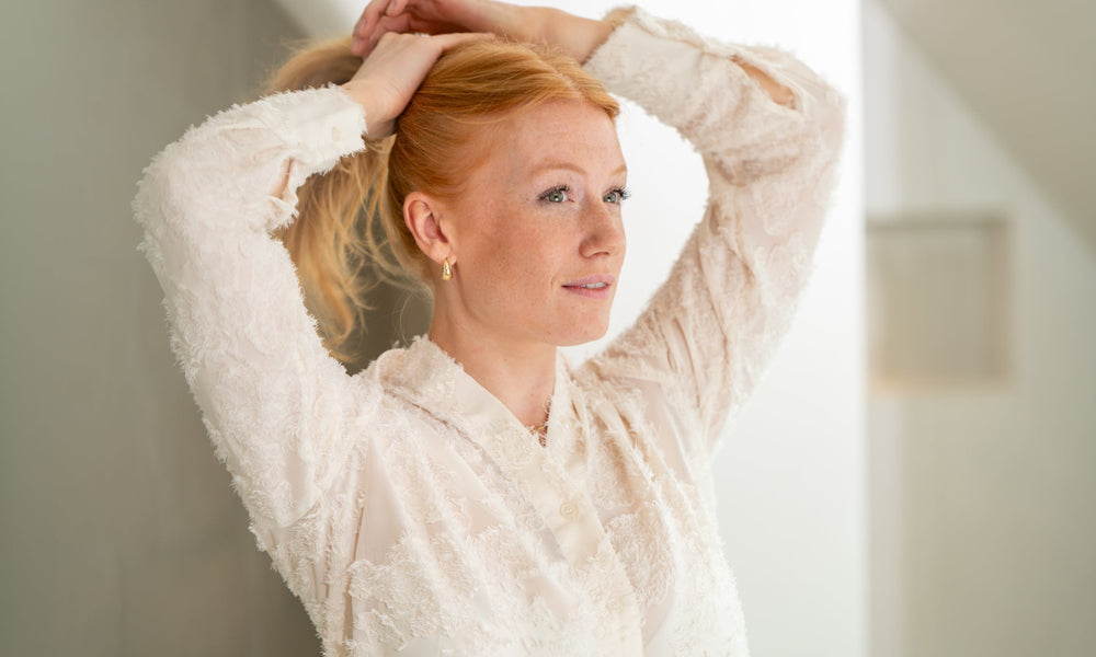 Traction alopecia: hair loss caused by tightly styled hairstyles
