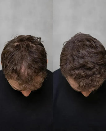 3x Keratain hair fibers + free Keratain pomade – Gray (25 gr) - Hair Growth Specialist