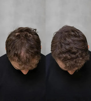 3x Keratain hair fibers + free Keratain pomade – Medium brown (25 gr) - Hair Growth Specialist