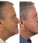 Foligain hair growth treatment (men) - Hair Growth Specialist
