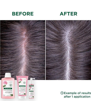 Klorane SOS serum sensitive scalp Peony (100 ml) - Hair Growth Specialist