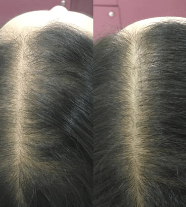 Revita conditioner (205 ml) - Hair Growth Specialist