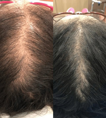 Revita conditioner (205 ml) - Hair Growth Specialist