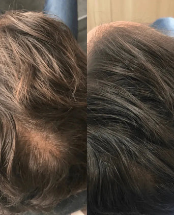 Revita shampoo til hårvækst (925 ml)