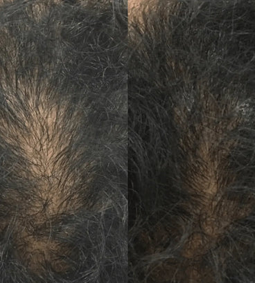 Revita tablets for hair growth (3 months) - Hair Growth Specialist