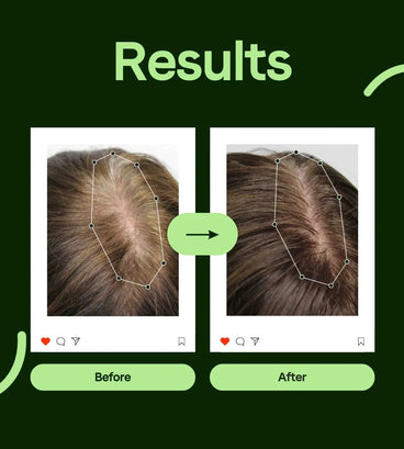 Scandinavian Biolabs Bio-Pilixin serum men (100 ml) - Hair Growth Specialist