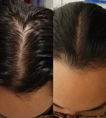 Scandinavian Biolabs Bio-Pilixin shampoo + conditioner women (250 ml) - Hair Growth Specialist