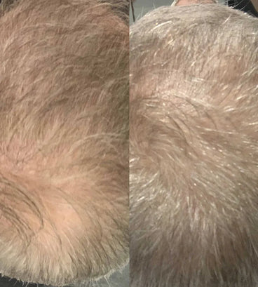Scandinavian Biolabs Bio-Pilixin shampoo men (250 ml) - Hair Growth Specialist