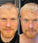 Scandinavian Biolabs hair growth treatment (men) - Hair Growth Specialist