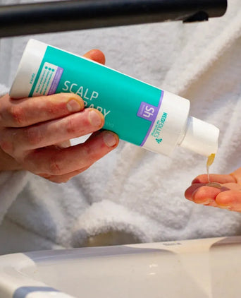 Seborrheic dermatitis scalp treatment - Hair Growth Specialist