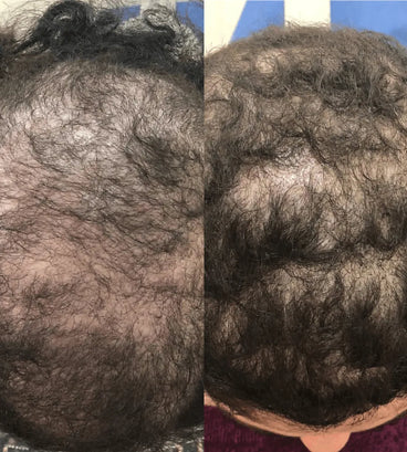 Spectral.CSF (Adenosine) lotion - Hair Growth Specialist