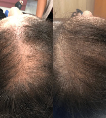 Spectral.CSF (Adenosine) lotion - Hair Growth Specialist