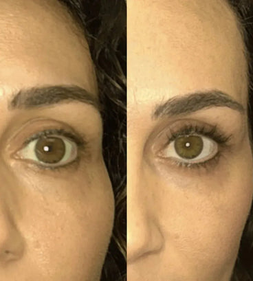 Spectral.LASH eyelash growth serum - Hair Growth Specialist