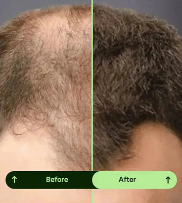 Toppik hair thickener color spray - black - Hair Growth Specialist