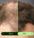 Toppik hair thickener color spray - black - Hair Growth Specialist