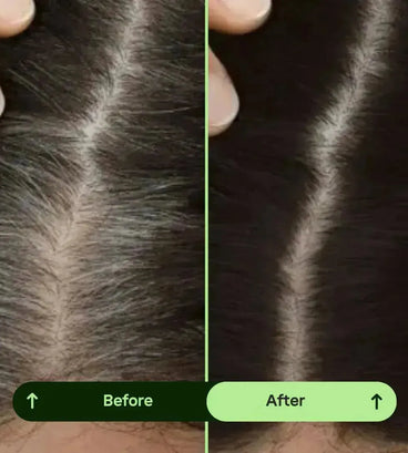 Toppik hair thickener color spray - black - Hair Growth Specialist