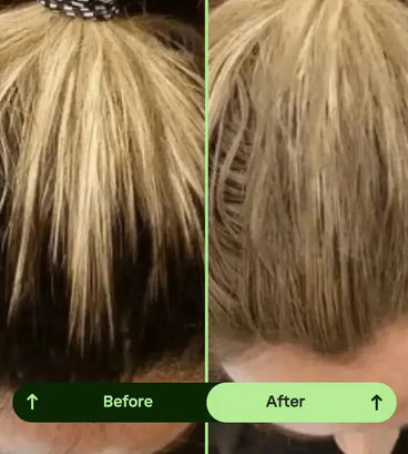 Toppik hair thickener color spray - black - Hair Growth Specialist