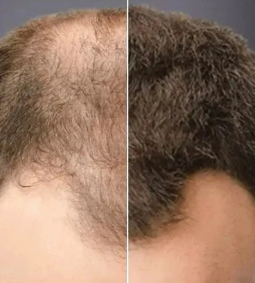 Toppik hair thickener color spray - Hair Growth Specialist