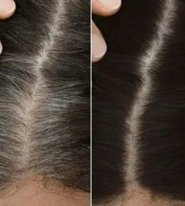 Toppik hair thickener color spray - Hair Growth Specialist