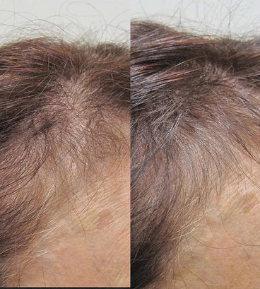 Viviscal hair growth tablets for women (1 month) - Hair Growth Specialist