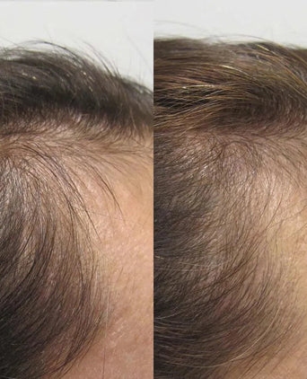 Viviscal hair growth tablets for women (3 months) - Hair Growth Specialist