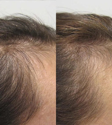 Viviscal hair growth tablets for women (3 months) - Hair Growth Specialist