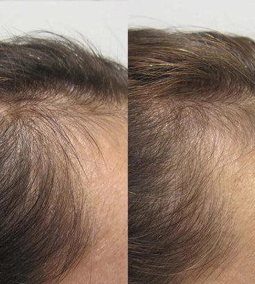 Viviscal hair growth tablets for women (3 months) - Hair Growth Specialist