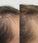 Viviscal hair growth tablets for women (3 months) - Hair Growth Specialist
