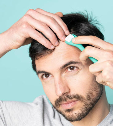 Neofollics scalp roller (0.3 mm) - Hair Growth Specialist